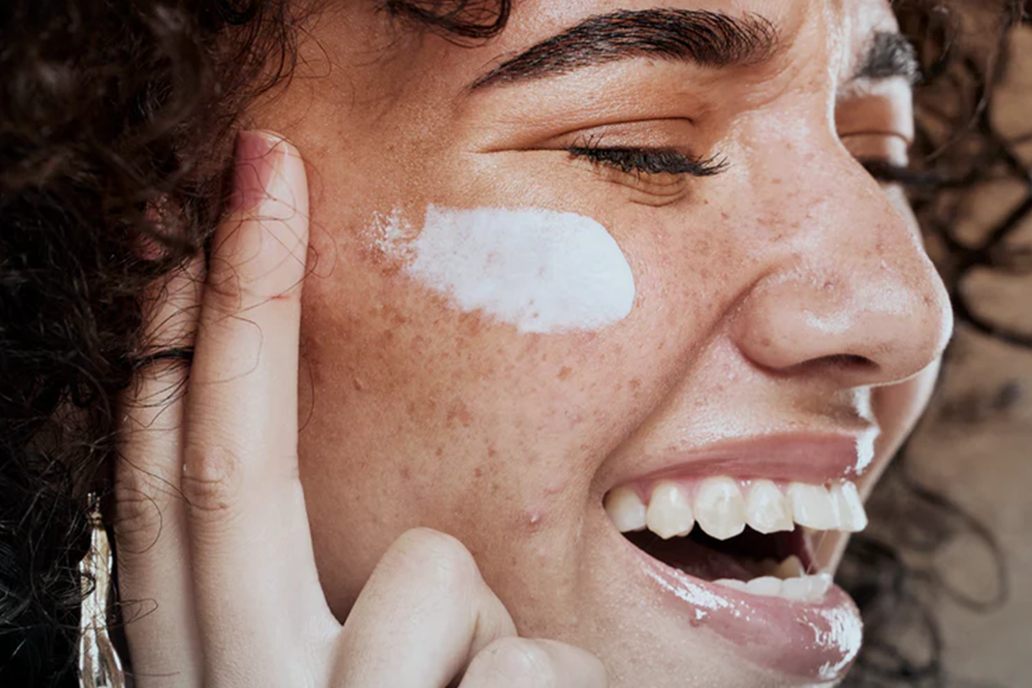 What Causes Skin Blemishes? The Best Solution to Prevent Them