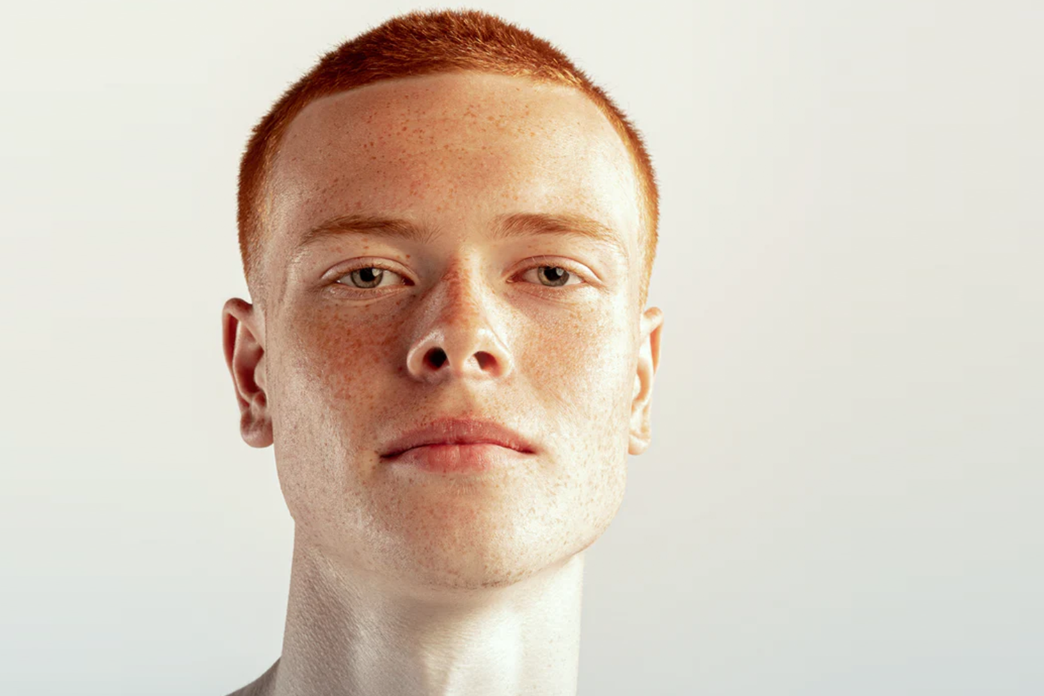 Male Pattern Baldness Symptoms: How to Prevent It
