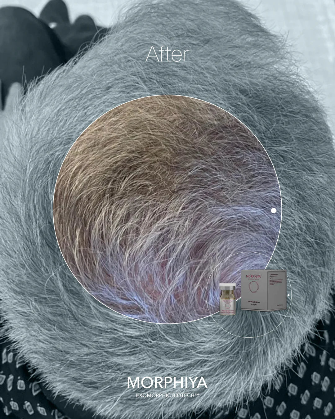 after-scalphybrid.webp__PID:a4b105c2-d914-429e-a717-45674d346da3